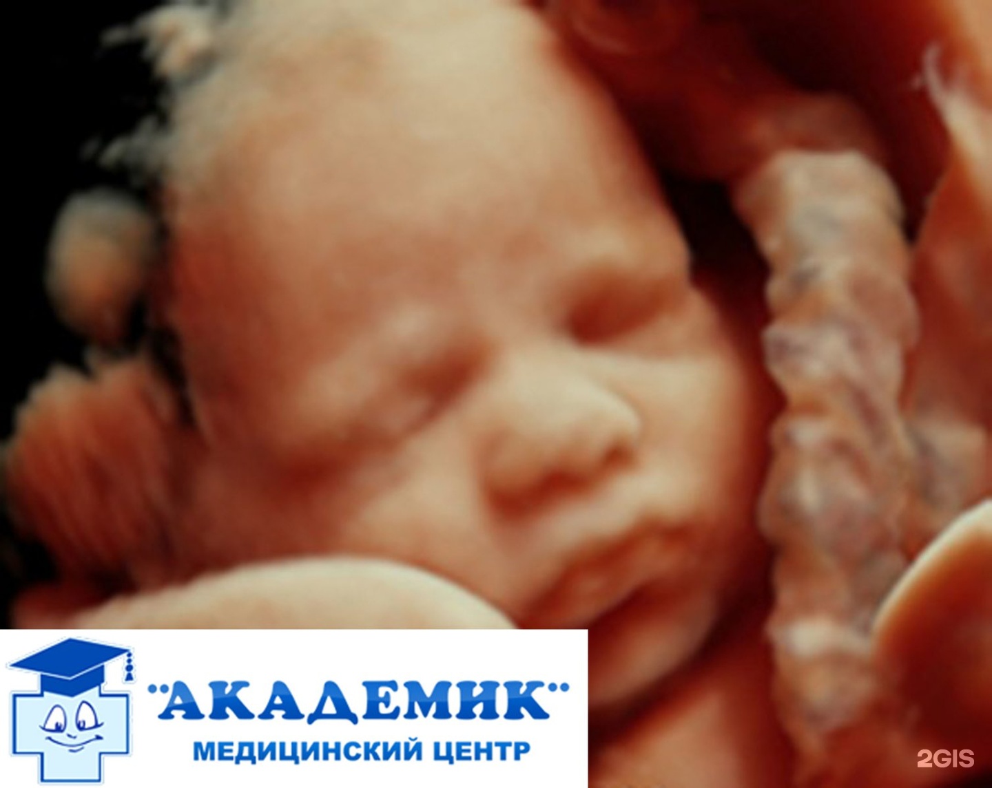 3d узи фото детей 3d узи фото детей