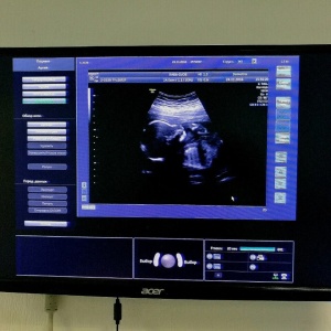 Фото от владельца Dеметра, клиника репродуктивного здоровья